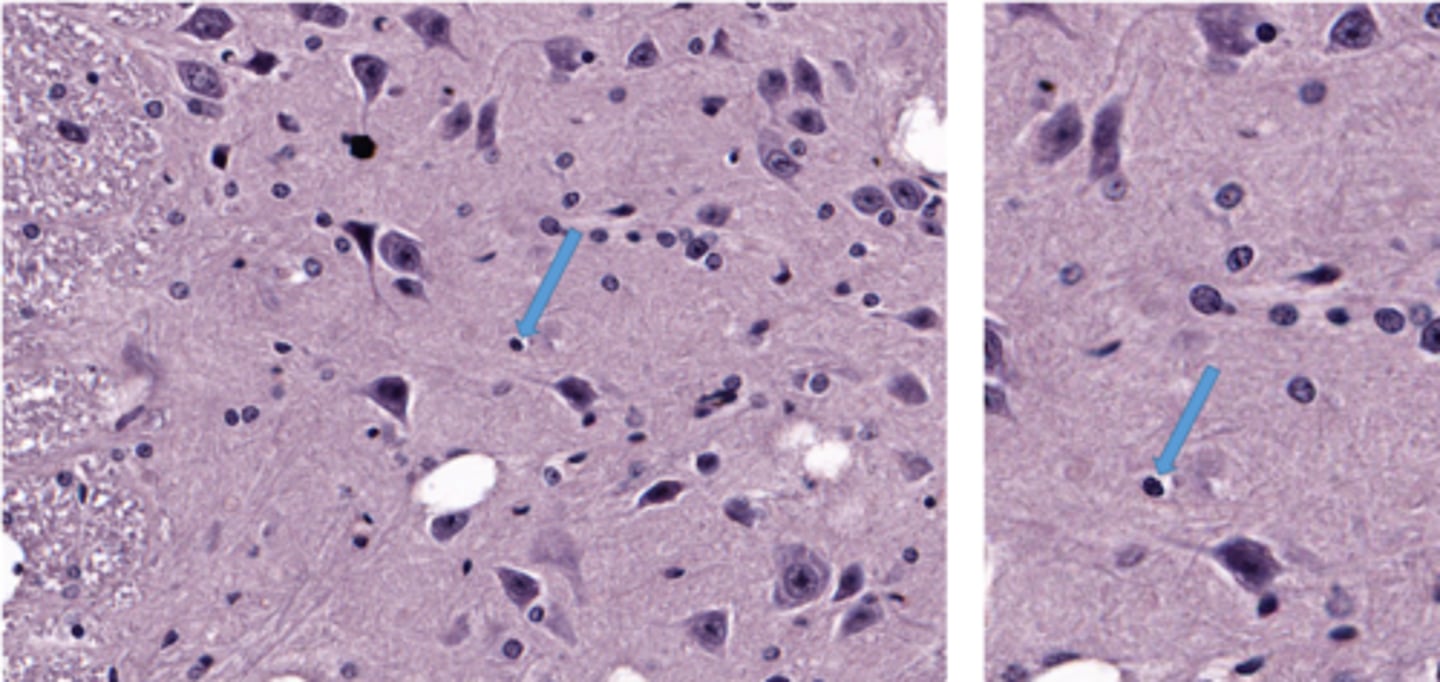 <p>Identify the glial cell</p>