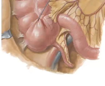 <p>Pain associated with the appendix may be associated with which dermatome/vertebral level?</p>