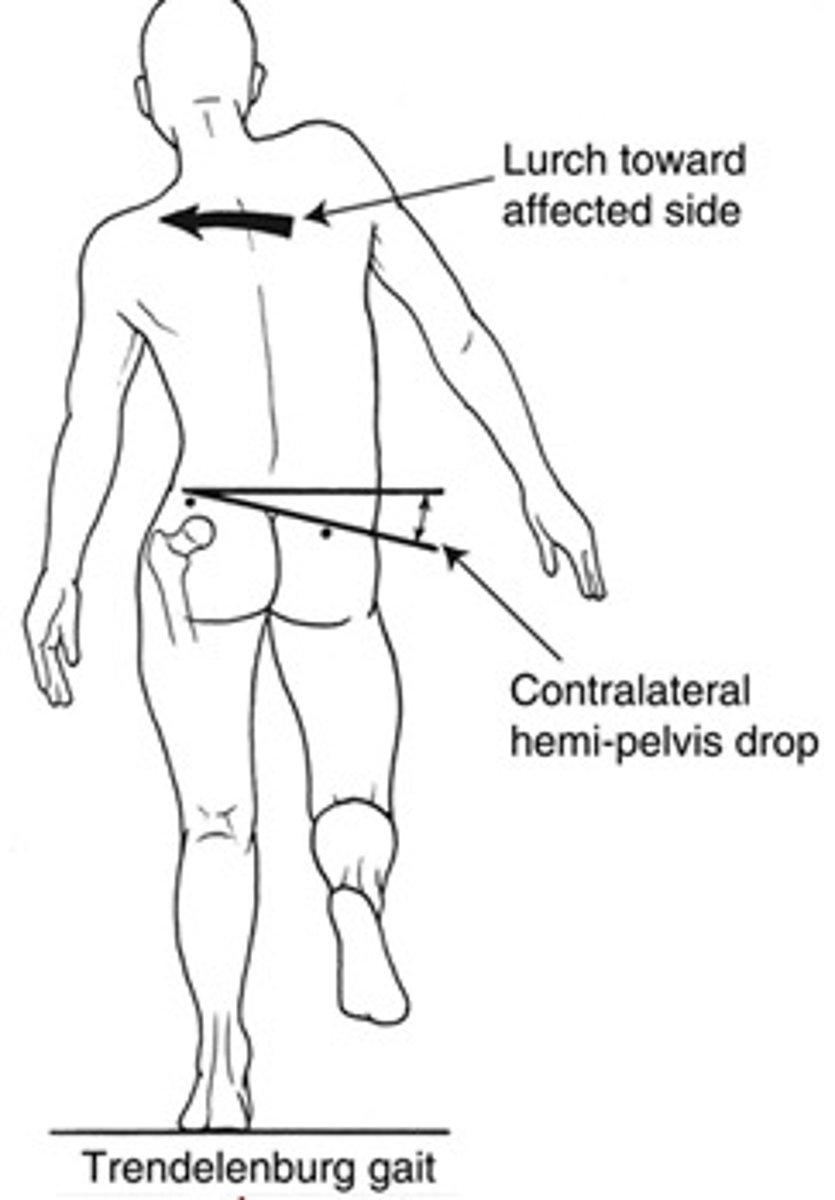<p>gait pattern that denotes gluteus medius weakness</p><p>*individual shifts the trunk over the affected side during stance phase</p>
