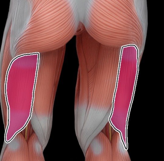 <p>lateral side of hamstrings</p>