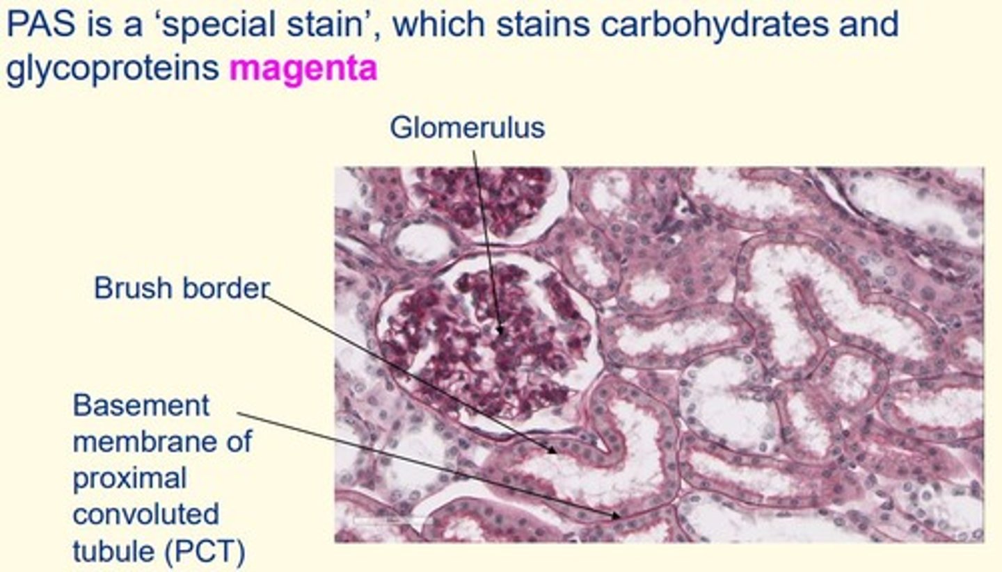 <p>- Stains carbohydrates and glycoproteins magenta</p>