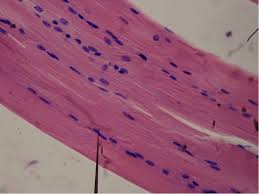 <p>What type of tissue is this?</p>
