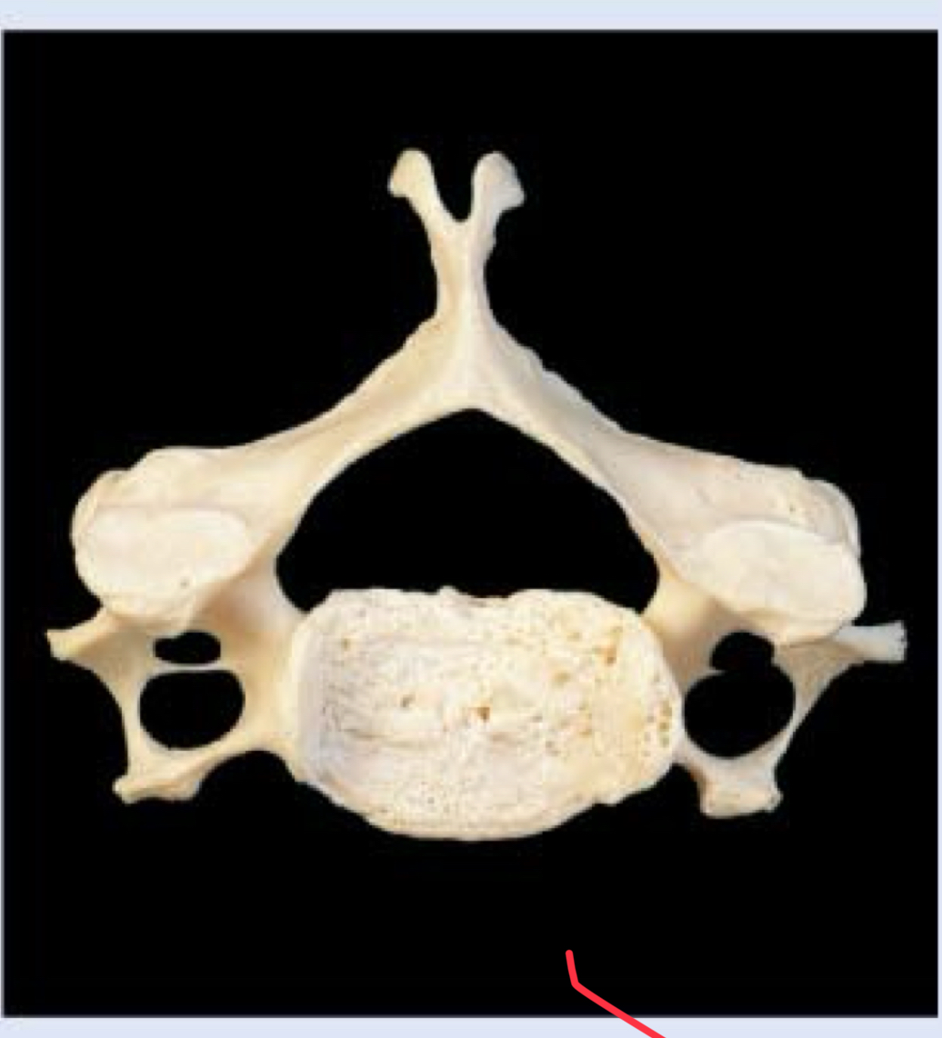 <p>What Vertebrae is this?</p>