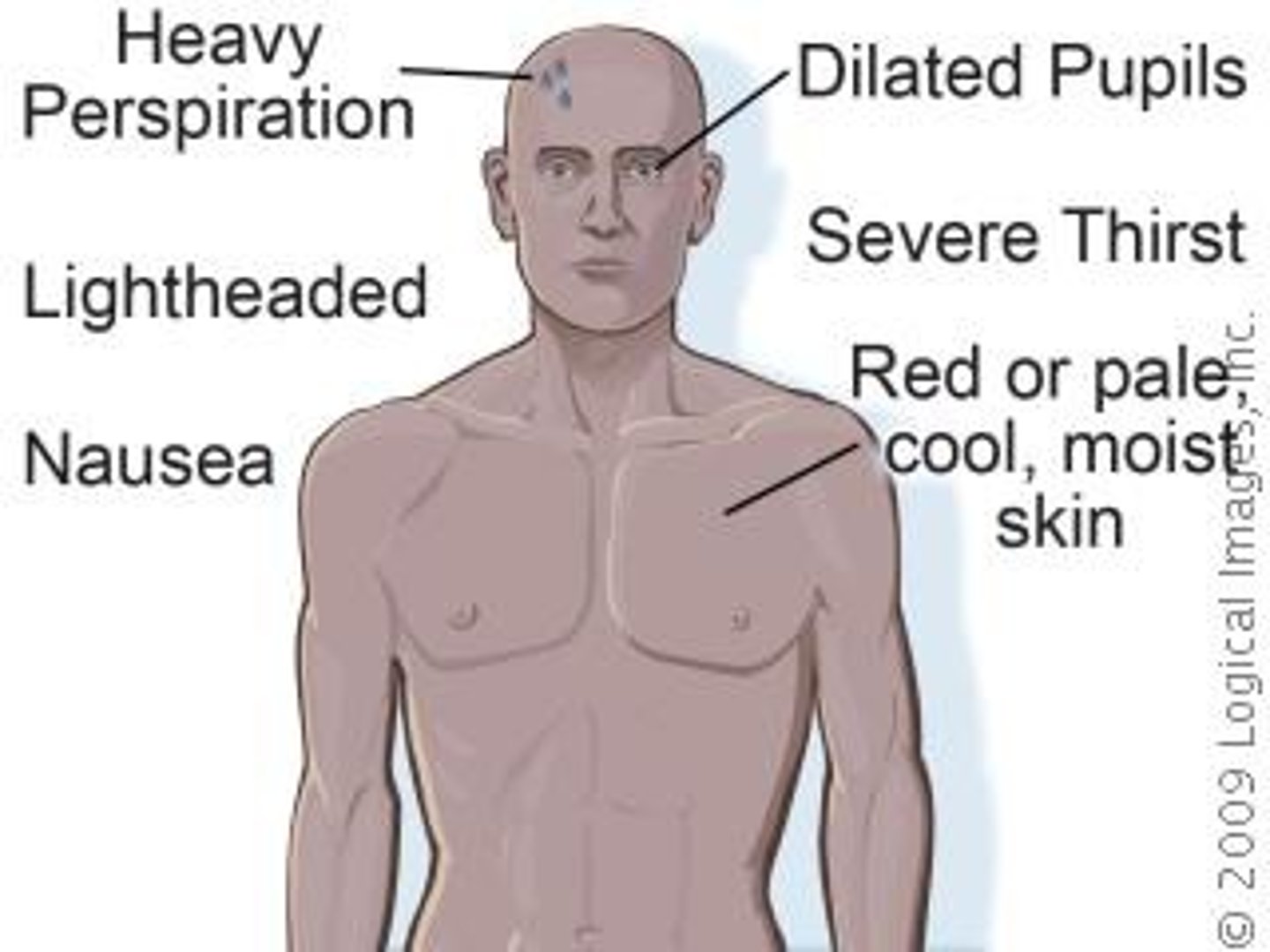 <p>cold, moist skin; normal or above skin temperature; headache; nausea; extreme fatigue (tiredness)</p>