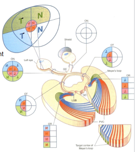 <p>They are reversed and inverted — upper visual fields project onto lower retina and vice versa</p>