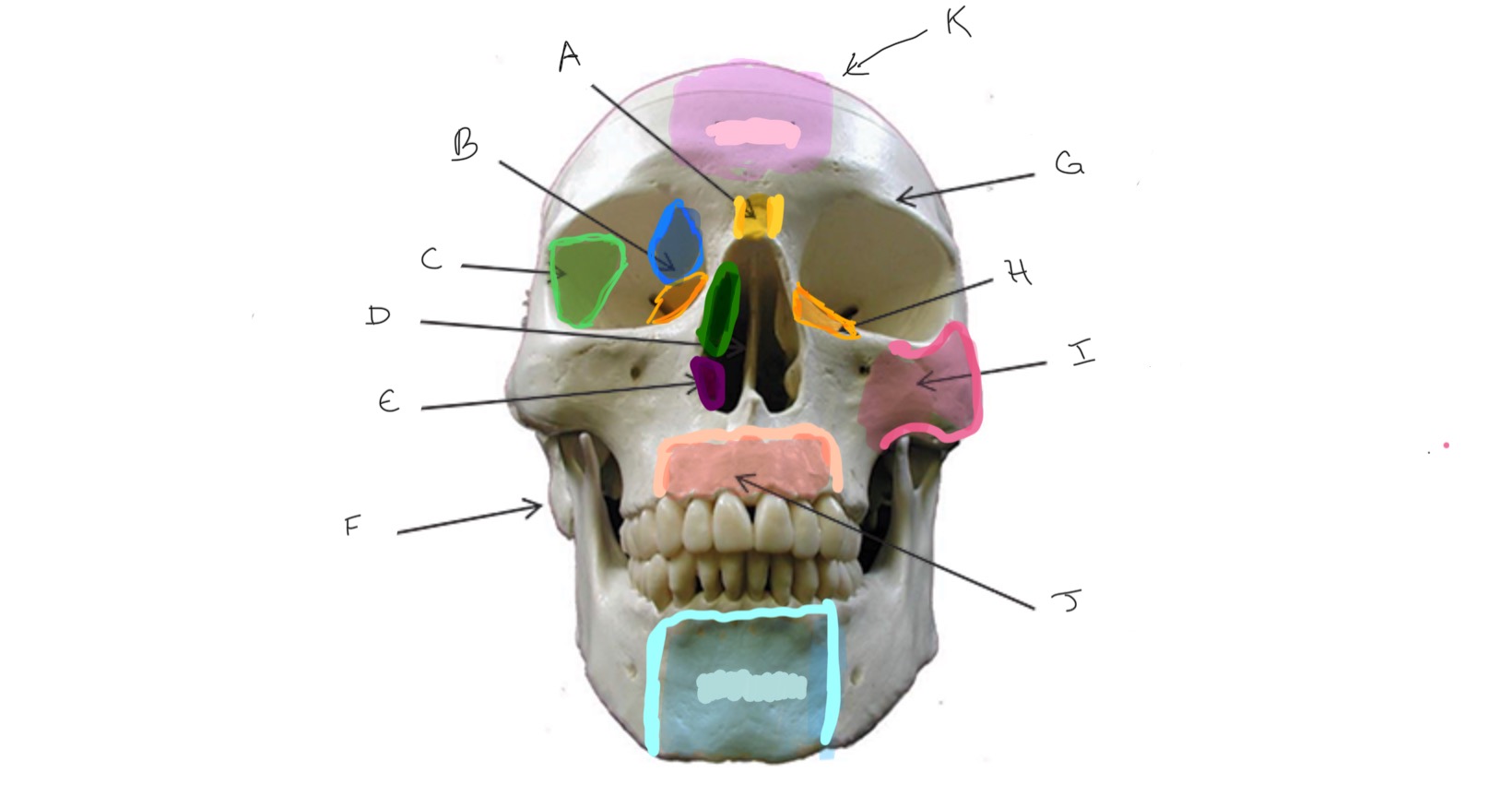 <p>Type of Bone: Skull (frontal)</p><p>What is I?</p>