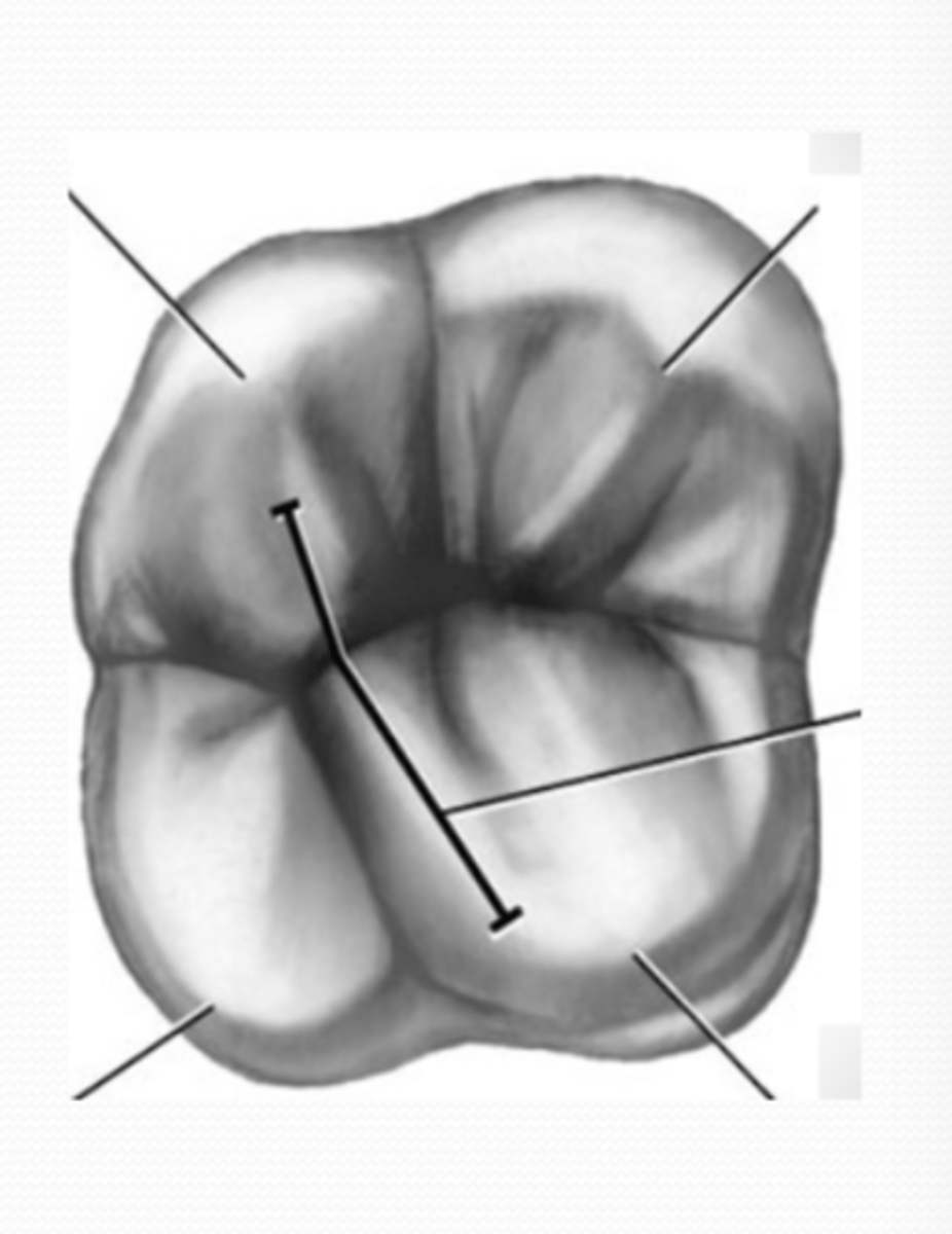 <p>Unique feature present on the occlusal of 1st and 2nd maxillary molars </p><p>Type of transverse ridge that crosses the occlusal obliquely from mesial to distal</p>