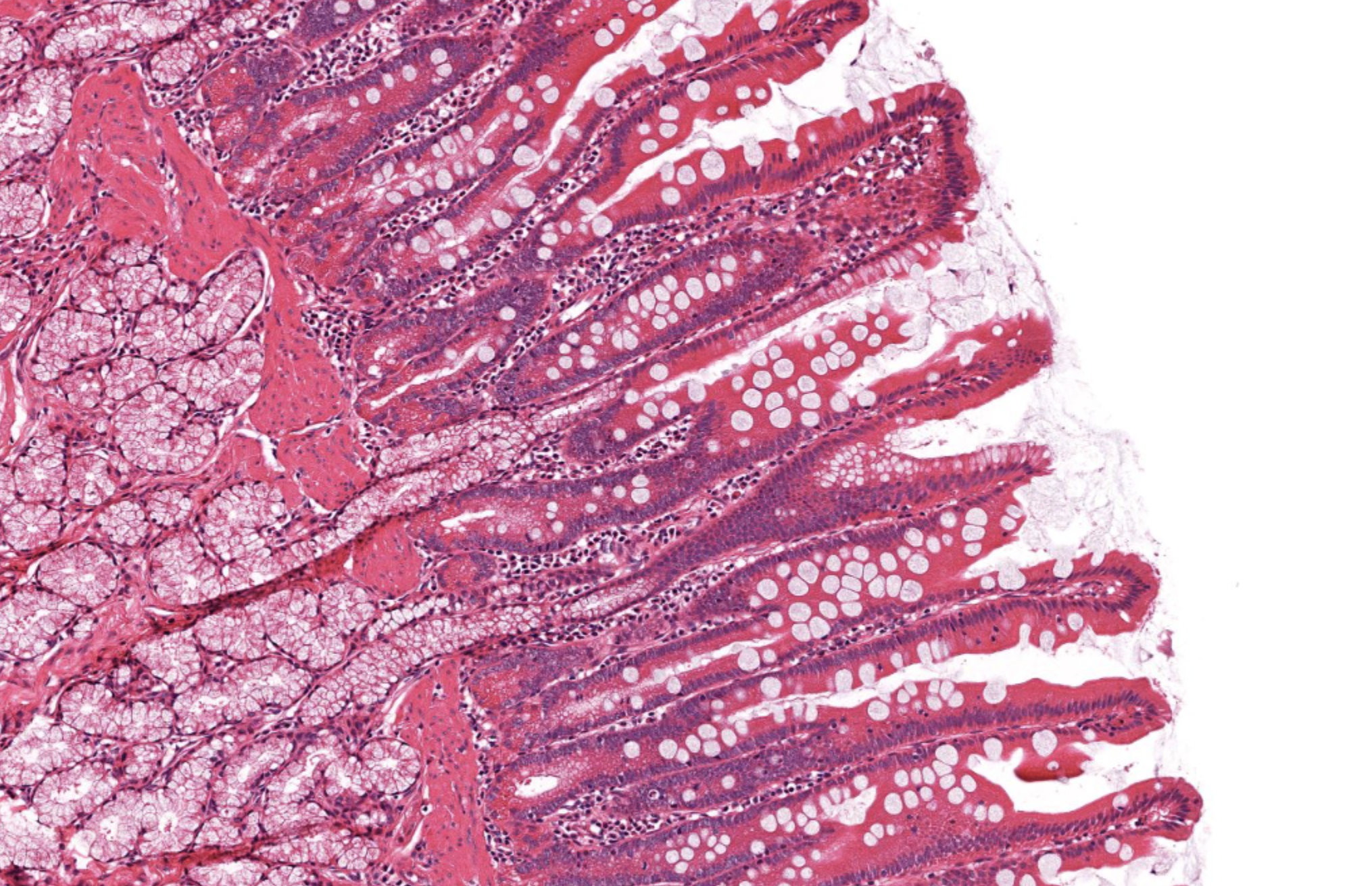 <p>Mucosa in Duodenum</p>