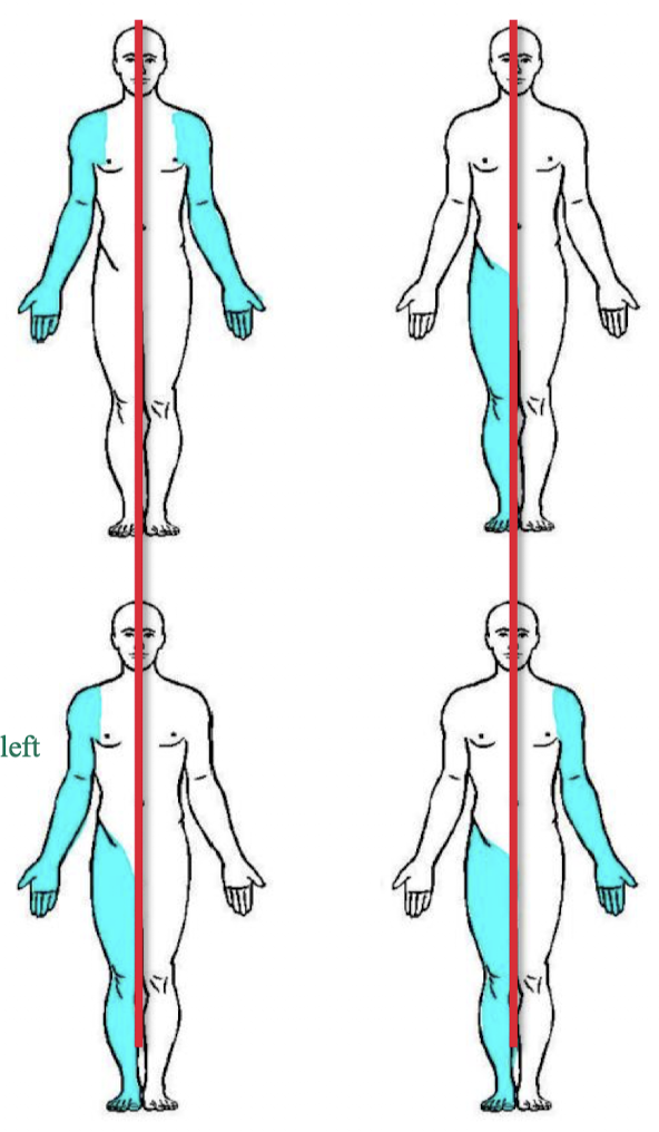 <ul><li><p><strong>right and left </strong>- always must describe from the position of the patient, must cross sides</p></li><li><p><strong>bilateral</strong> - describing paired structures (e.g structures that you have both left and right like arms, kidneys, lungs, etc.)</p></li><li><p><strong>unilateral </strong>- describing one side of the body  (i.e. heart is unilateral left)</p></li><li><p><strong>ipsilateral</strong> - describing structures on the same side of the body (i.e. spleen is ipsilateral to the stomach, both are on left side of the midline)</p></li><li><p><strong>contralateral</strong> - describing structures on opposite sides of the body</p></li></ul><p></p>