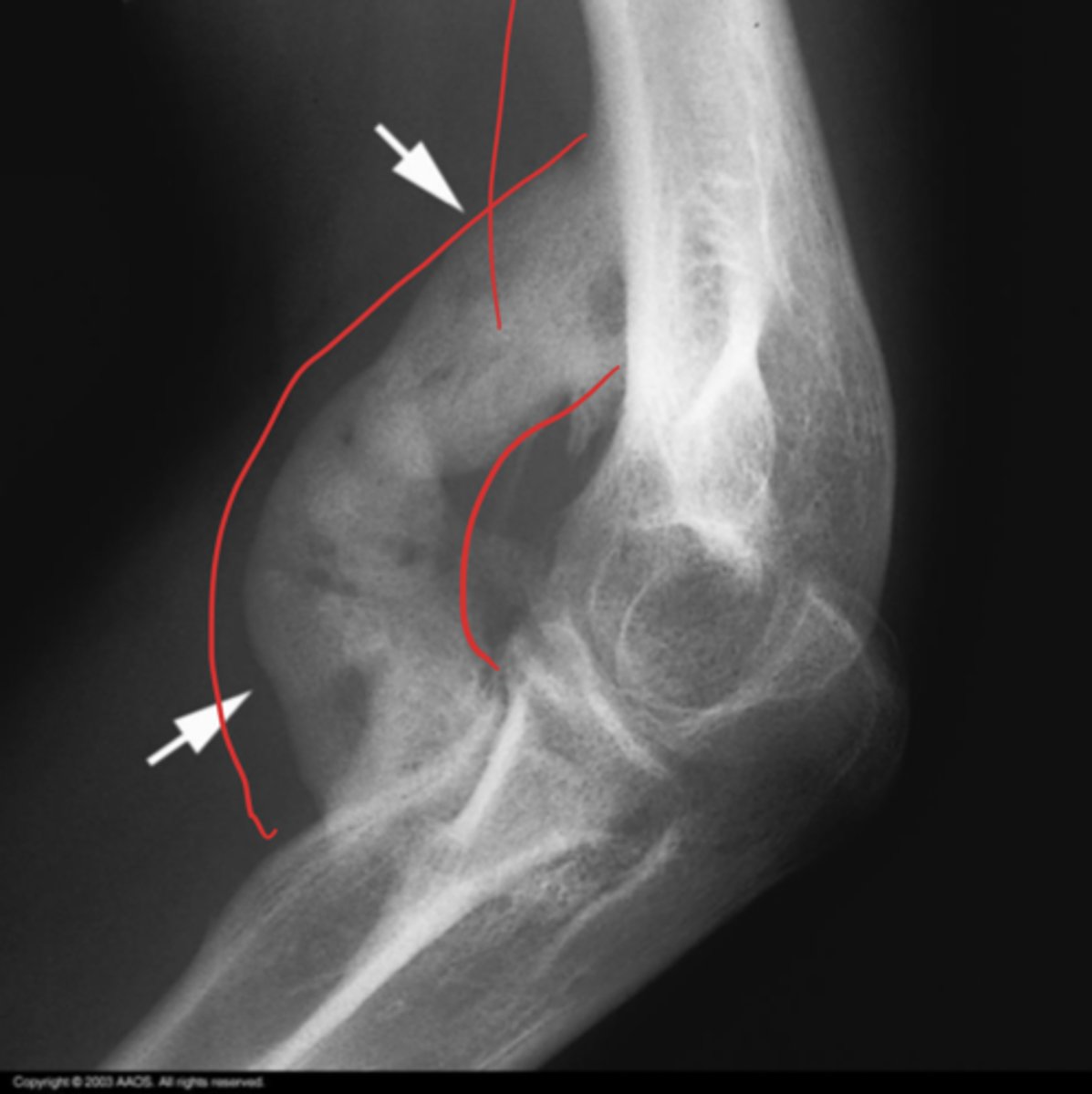 <p>What is the issue?</p>