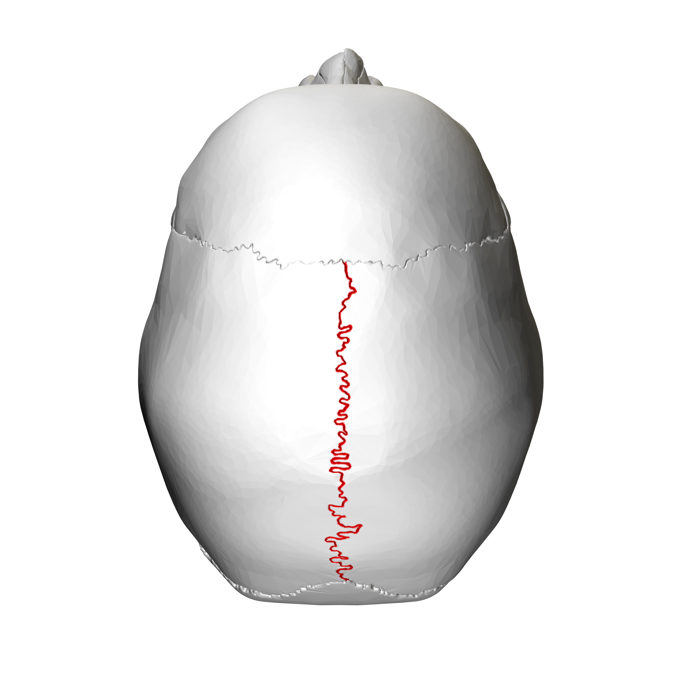 <p>Seperates the two parietal bones, along the midsagittal plane</p>