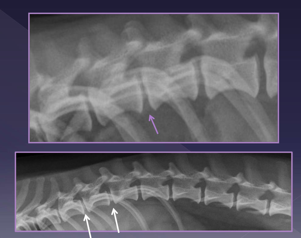 <p>Diagnosis of intervertebral disk herniation </p>