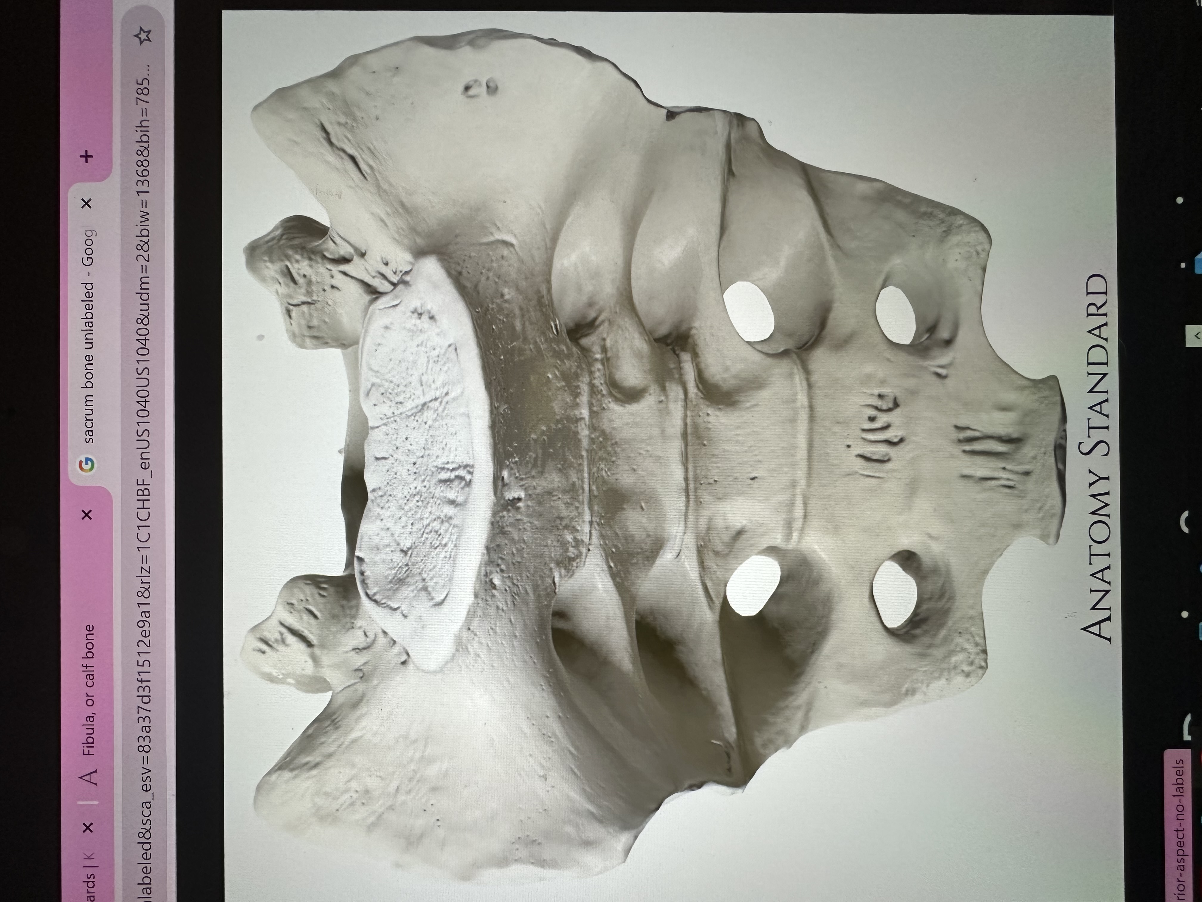 <p>what bone is this?</p>