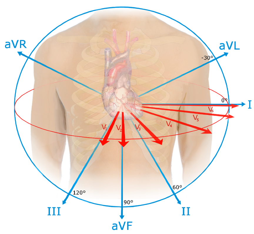 <ol><li><p>3-D structure in 2-D</p></li><li><p>ECG is single snapshot of flow of electricity through heart at 12 different angles</p><ol><li><p>Laterally, frontally, anteriorly, posteriorly</p></li></ol></li><li><p>If you only took a single view you might miss something</p></li><li><p>What can be observed from the 12 leads:</p><ol><li><p>HR Rhythm or Arrythmia</p></li><li><p>Normal conduction pattern</p></li><li><p>Conduction block due to damaged/abnormally functioning cells</p></li><li><p>Altered orientation of heart</p></li><li><p>Hypertrophy (enlargement (elevated BP?))</p></li><li><p>Atrophy (reduction in size (heart attack?))</p></li></ol></li><li><p>Leads most parallel to ventricles have biggest QRS</p></li><li><p>Leads most perpendicular to ventricles have smallest QRS</p></li></ol>