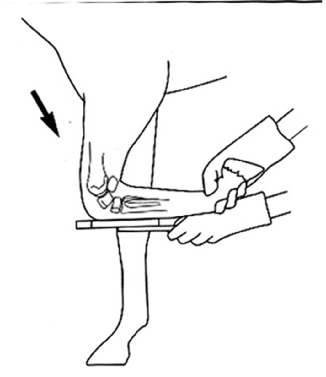 <p>What view is being taken?</p>