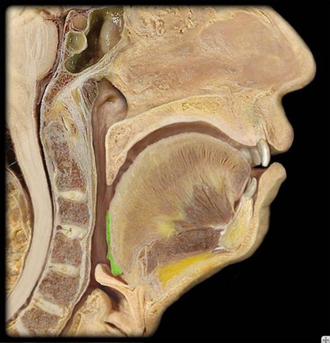 <p>Name this highlighted structure.</p>