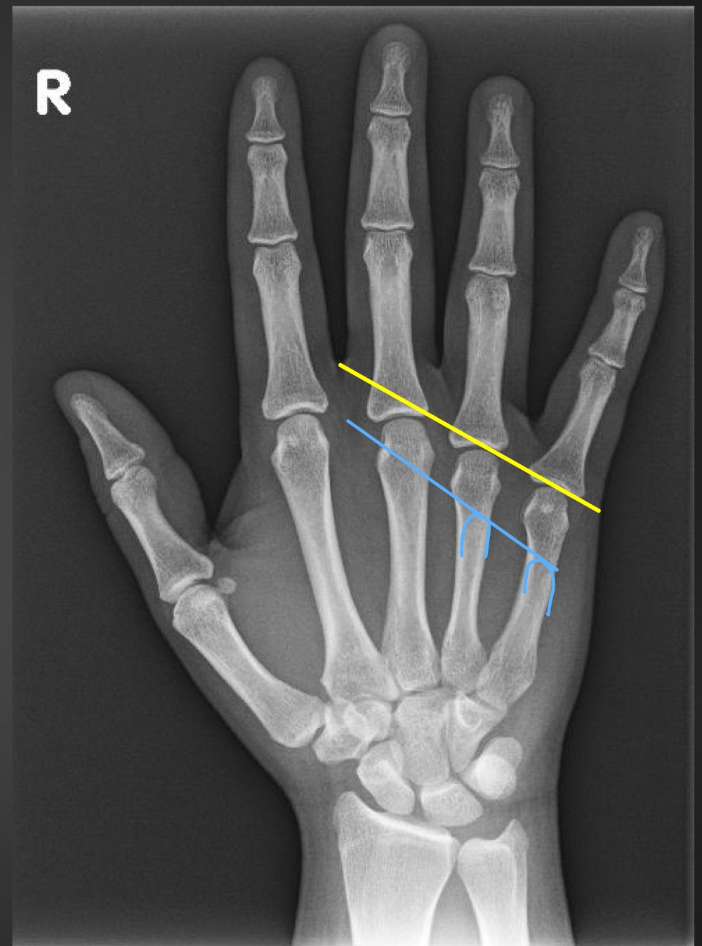 <p>what is this measurement and what is considered normal </p>