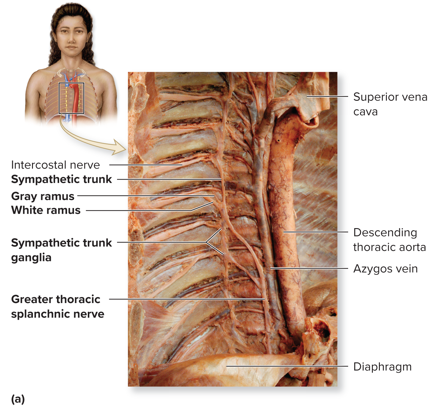 <ul><li><p>Left and right trunks just lateral to the vertebral column</p></li><li><p>Trunk resembles a string of pearls </p><ul><li><p>“string” composed of axons</p></li><li><p>“pearls” composed of sympathetic trunk ganglia housing cell bodies</p></li></ul></li></ul><p></p>