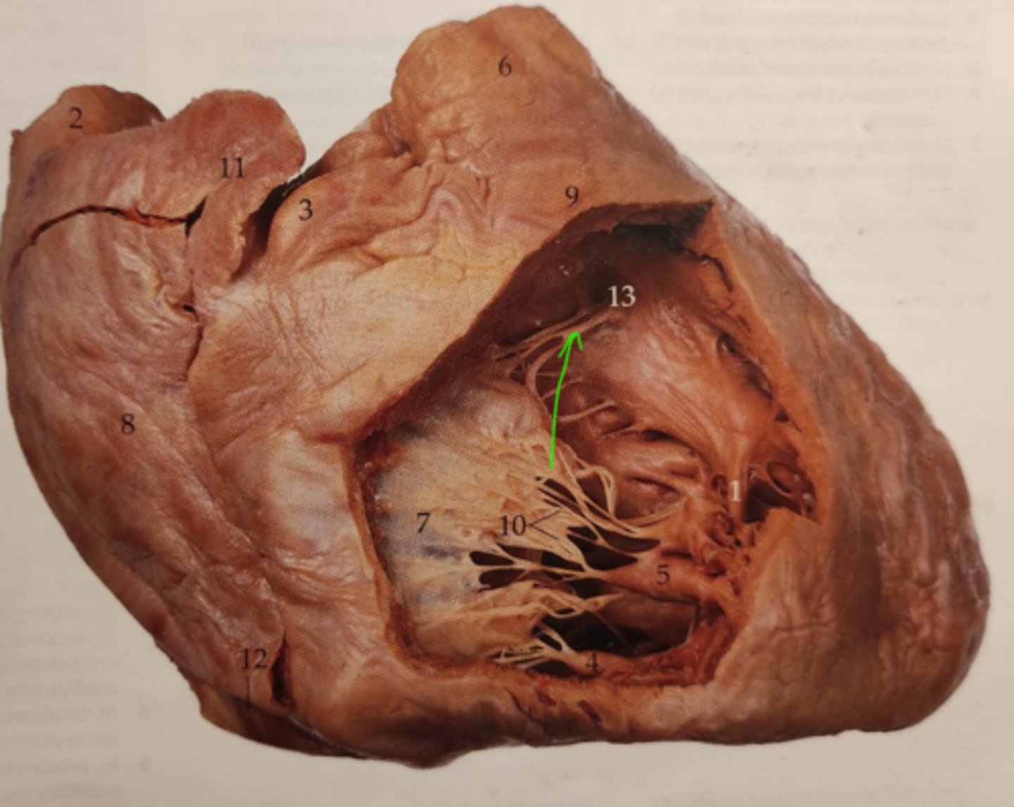 <p>Name the Muscle of the Right Ventricle</p>