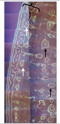 <p></p><ul><li><p>A round structure in formation that has blood vessels in the middle</p></li><li><p>Forms tubes that run the length of the bone, pack together and provide strength to the bone. </p></li><li><p>Primary and secondary osteons</p></li><li><p>secondary osteons are formed off a primary one (e.g. motorway is the big main road, country roads come off it)</p></li><li><p>secondary osteons are more likely to move across the bone (width), transversely. </p></li><li><p>White arrows are the primary, black arrows are the secondary (hard to tell apart)</p></li></ul><p></p>