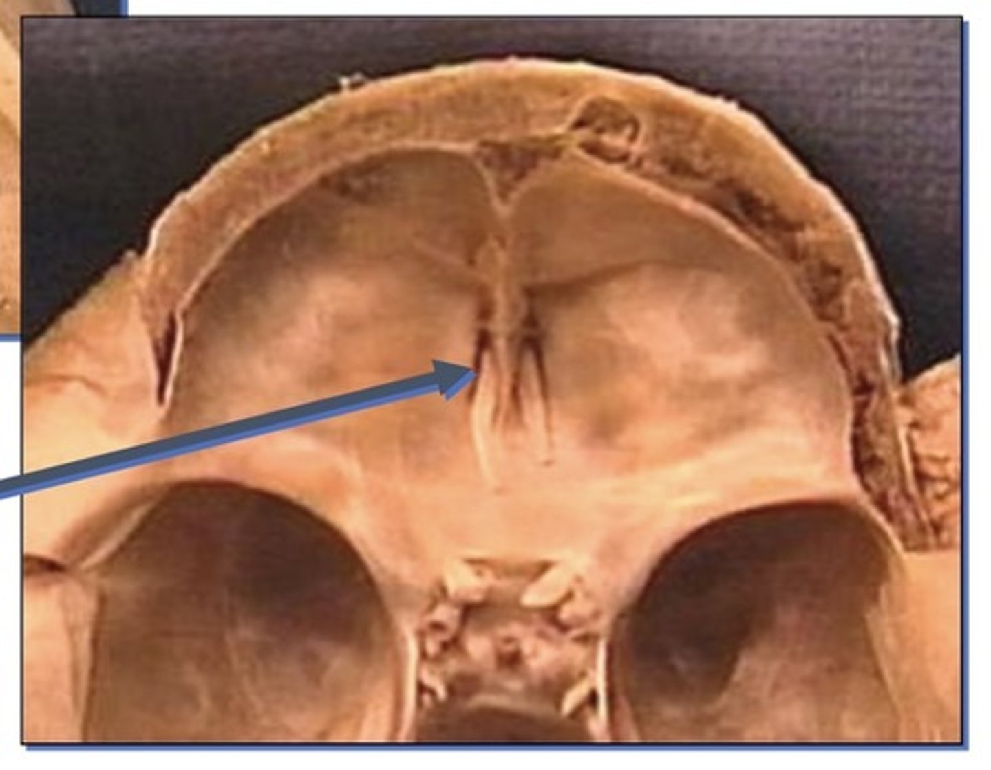 <p>1. Related to olfactory nerves by the olfactory bulbs that overly it</p><p>2. Gives the sense of smell</p>