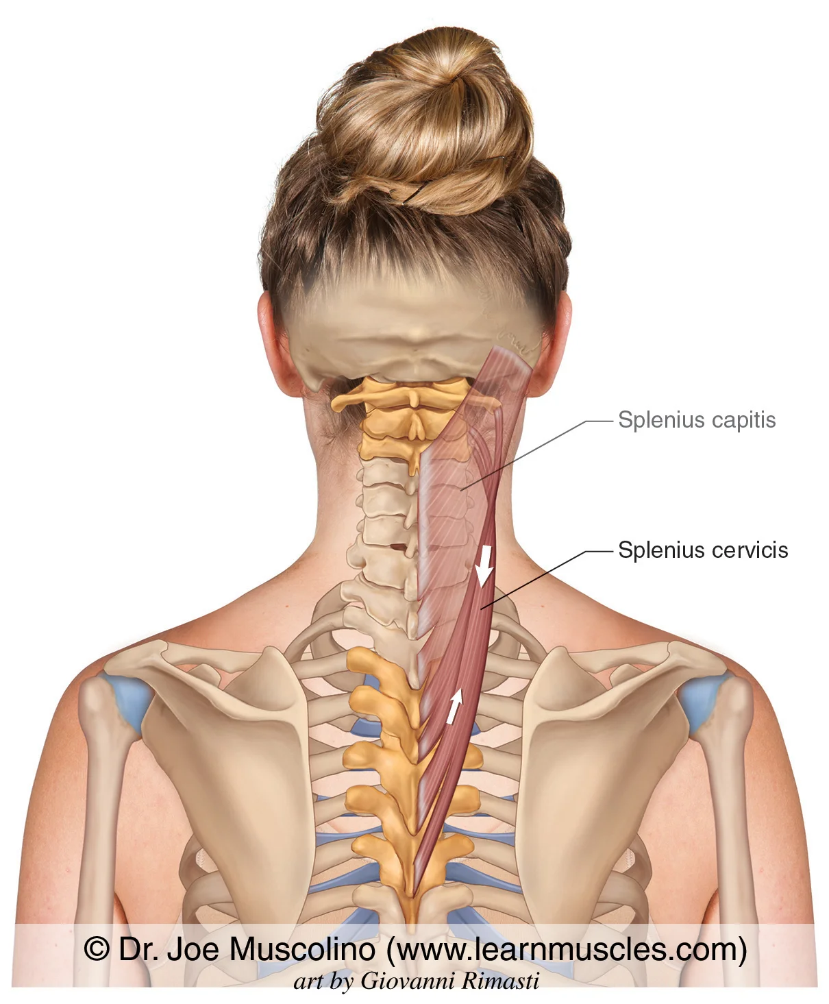 <p>Splenius Cervicis (Intrinsic Back Muscle (Superficial)/lateral vertebral muscle)</p><p>Origin?</p><p>Insertion?</p><p>Action?</p><p>Innervation?</p>