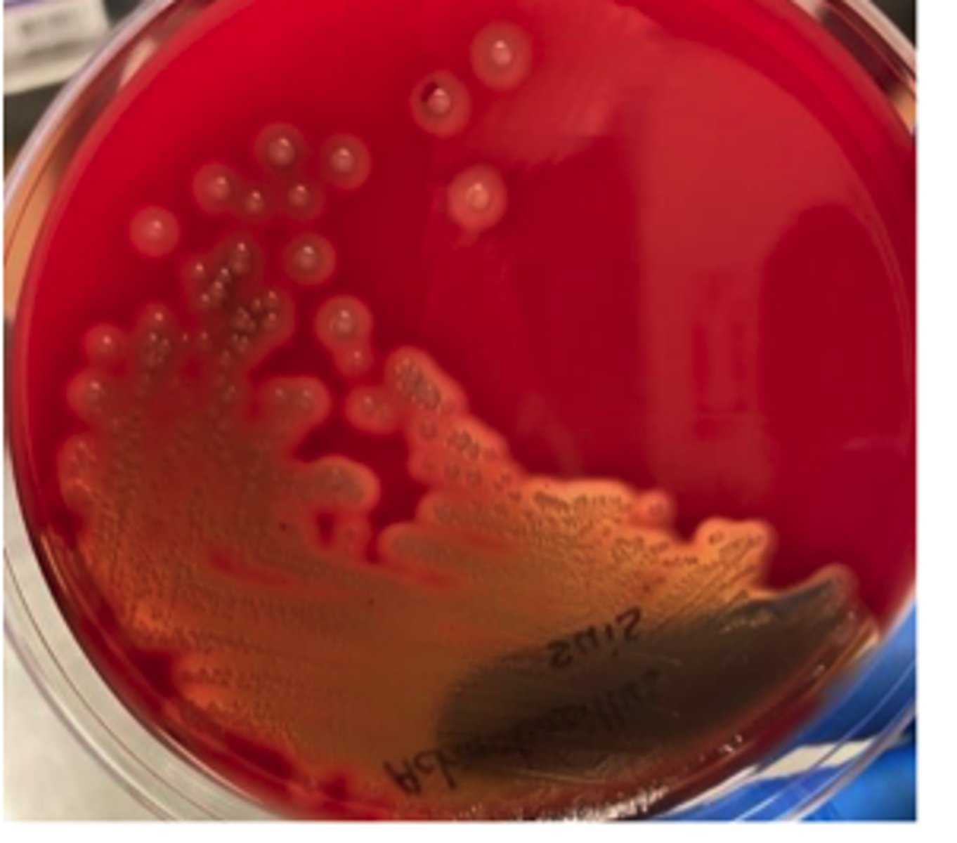 <p>A group of nursery pigs suddenly develops high fever, respiratory distress, and acute death, and survivors show multifocal skin hemorrhages and necrotic, embolic lesions in the lungs, liver, and spleen resembling septicemia.</p><p>It is not NAD dependent </p><p>Describe BA + Presumptive Identification</p>
