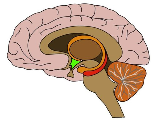 term image