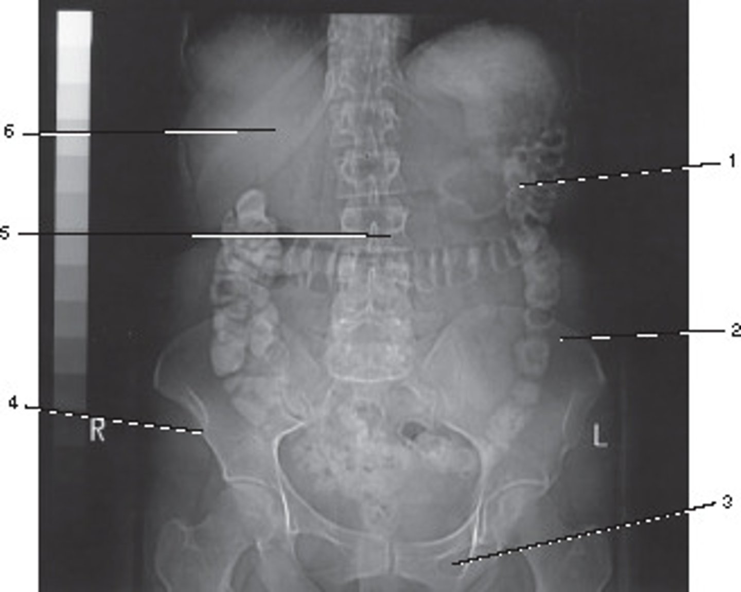<p>This localizer (scanogram) could be used to program which of the following examinations?</p>
