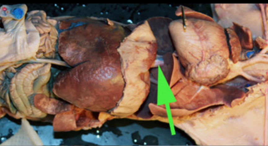 <p><span>The vessel marked by the green arrow is the</span> <strong>inferior vena cava</strong></p>
