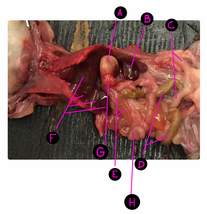 <p>Where are the hepatic lobes?</p>
