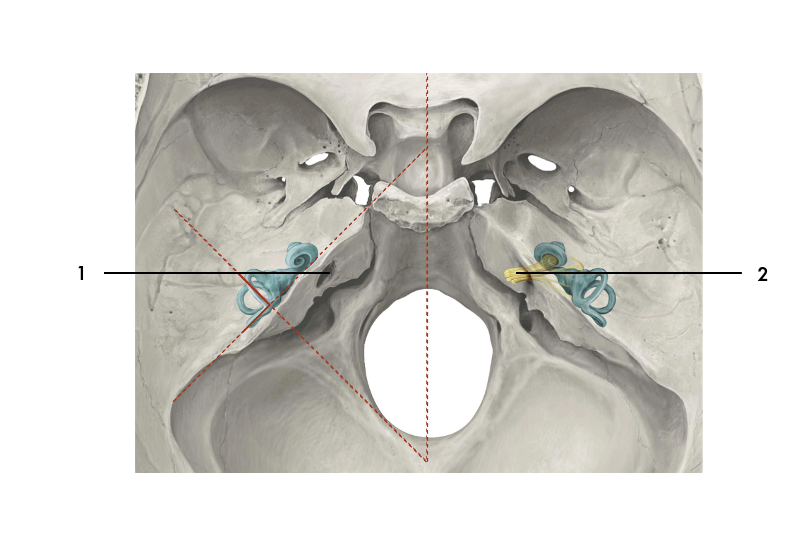 Nerfs facial et vestibulo-cochléaire
