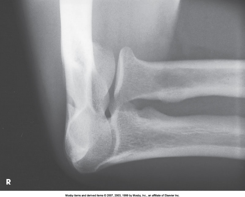 <p>What position is demonstrated?</p>