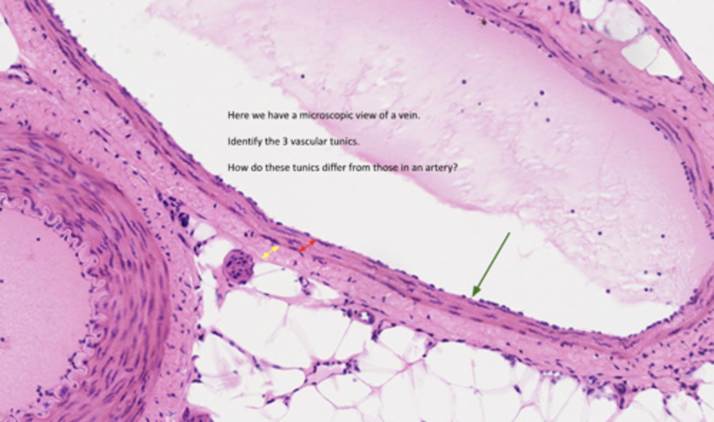 <p>What are the green arrows?</p>
