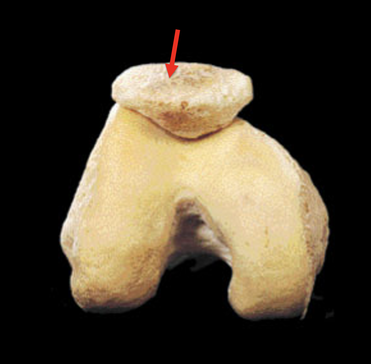 <p>Name this bone</p>
