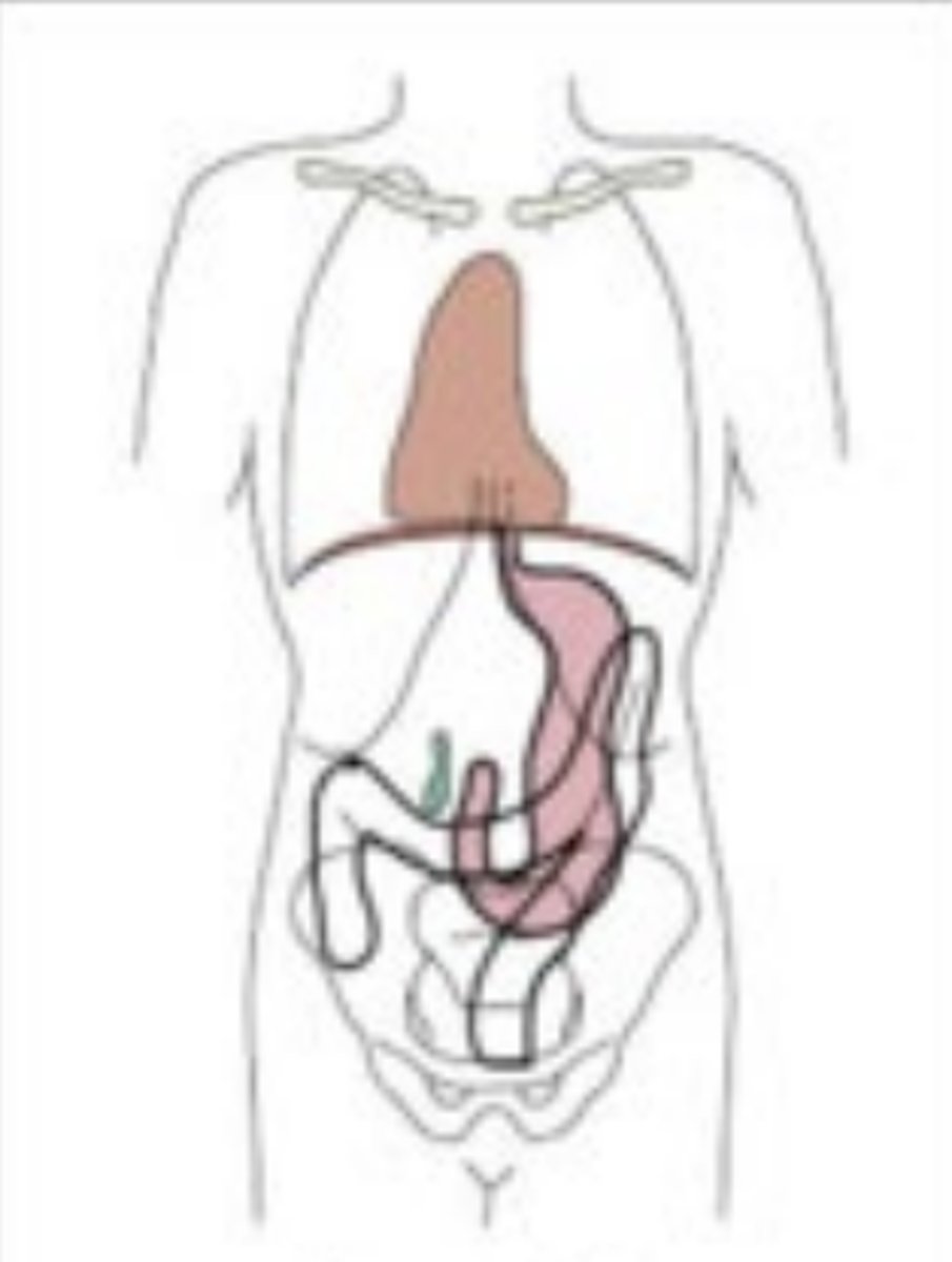 <p>Type of Body Habitus</p>