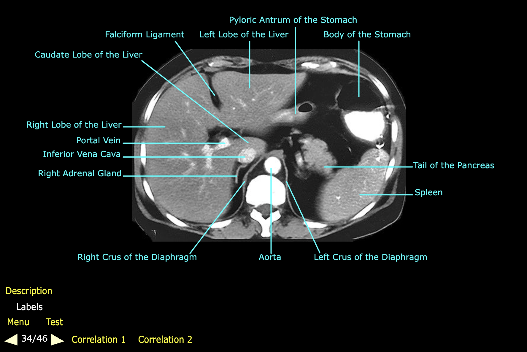 knowt flashcard image
