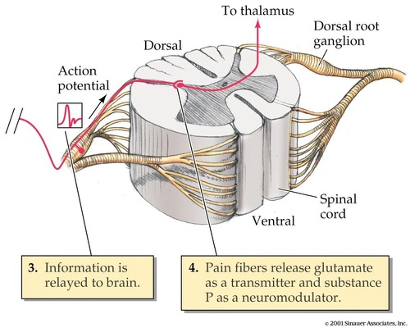 <p>It relays nociceptive input to the somatosensory cortex for sensory discrimination.</p>