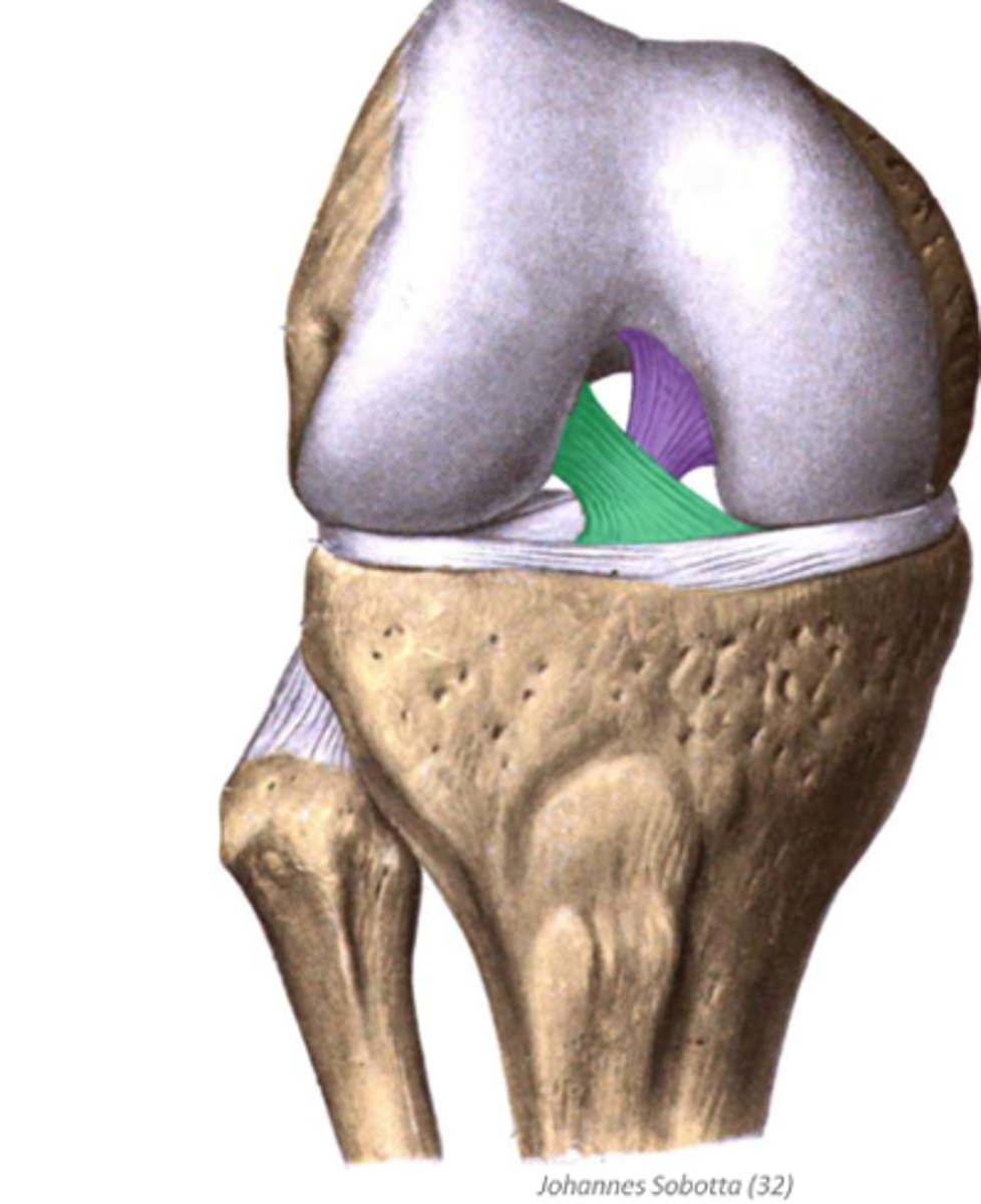 <p>attaches on posterior aspect of intercondylar eminence of tibia, projects anteriorly and medial to ACL to insert just lateral to the medial condyle of the femur</p><p>prevents posterior glide of tibia on femur and limits medial rotation</p><p>*purple in image</p>