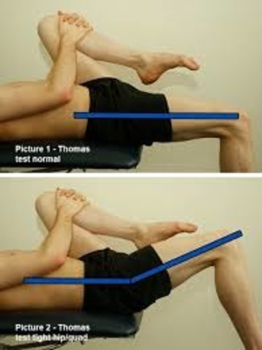<p>•The Thomas test evaluates the length of the one and two joint muscles that flex the hip</p><p>•Testing Position: Supine with knees to chest at end of table</p><p>•Stabilization: Knee to chest stabilizes spine</p><p>•Testing motion: Lower one leg while stabilizing spine with other knee to chest (compare each side)</p><p>•End feel: firm</p><p>•Interpretation: If the testing leg's thigh lies flat on the table, and the knee remains in at least 80 degrees of flexion, the iliopsoas and rectus femoris muscles are of normal length</p><p>+ if straight leg rises off table</p><p>•Measure to document progress - goniometer alignment as with hip flex</p><p>•Positive finding: Iliopsoas vs Rectus femoris tightness</p><p>•If positive findings, extend knee, if no change in thigh position=Iliopsoas tightness and/or joint structures such as the anterior joint capsule, iliofemoral ligament, &amp; ischiofemoral ligament</p><p>•If thigh returns to table with knee ext=rectus femoris tightness</p>