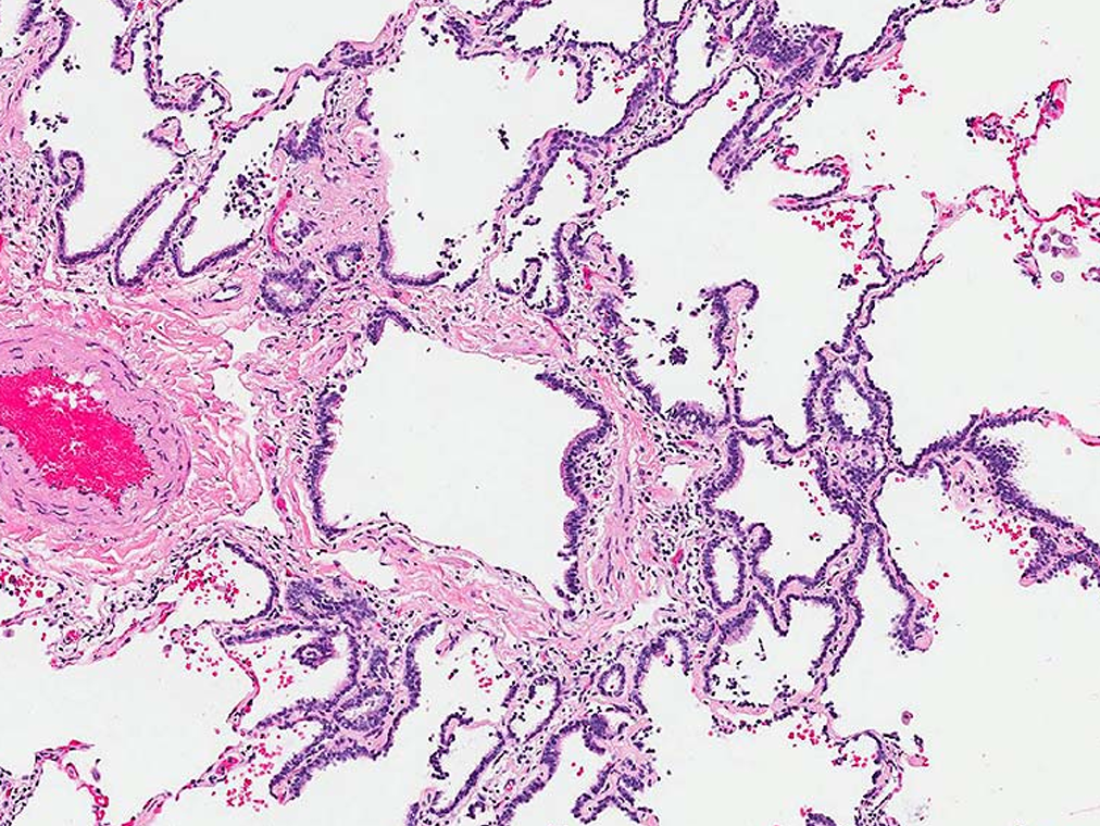 <p>Term for this histologic change? </p>