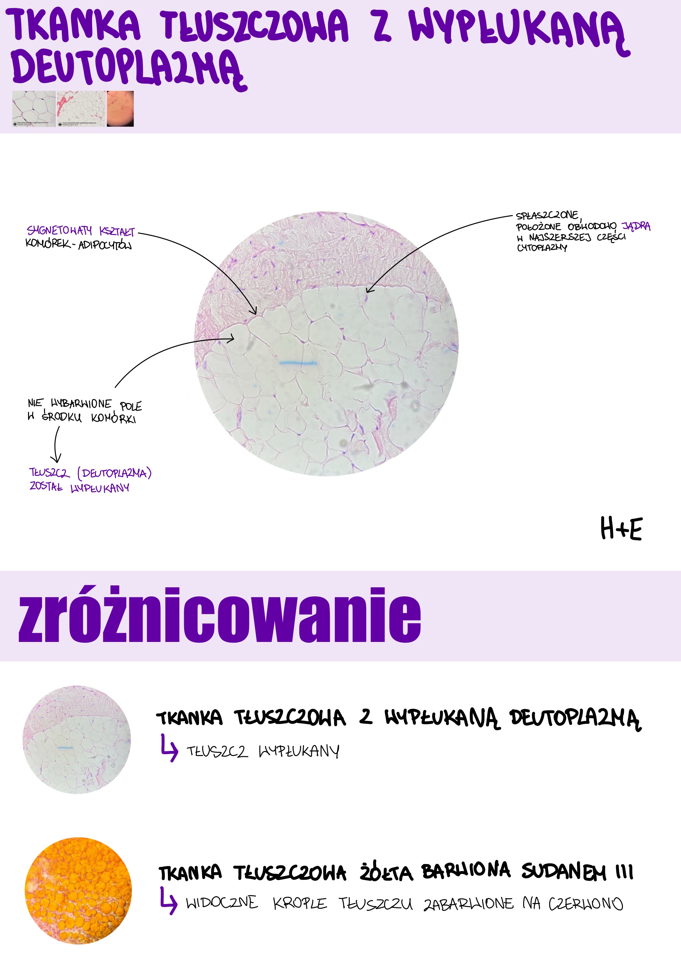 <p>Tkanka tłuszczowa z wypłukaną deutoplazmą</p>