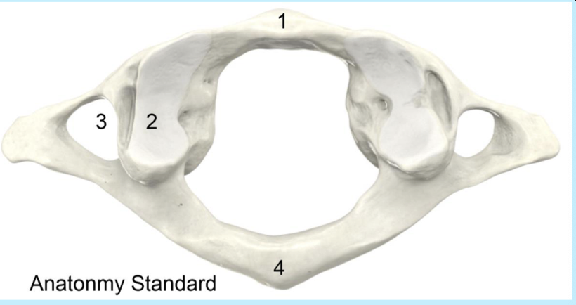 <p>1- anterior arch 2 superior articular facet&nbsp;3. transverse foramen 4. posterior arch </p>