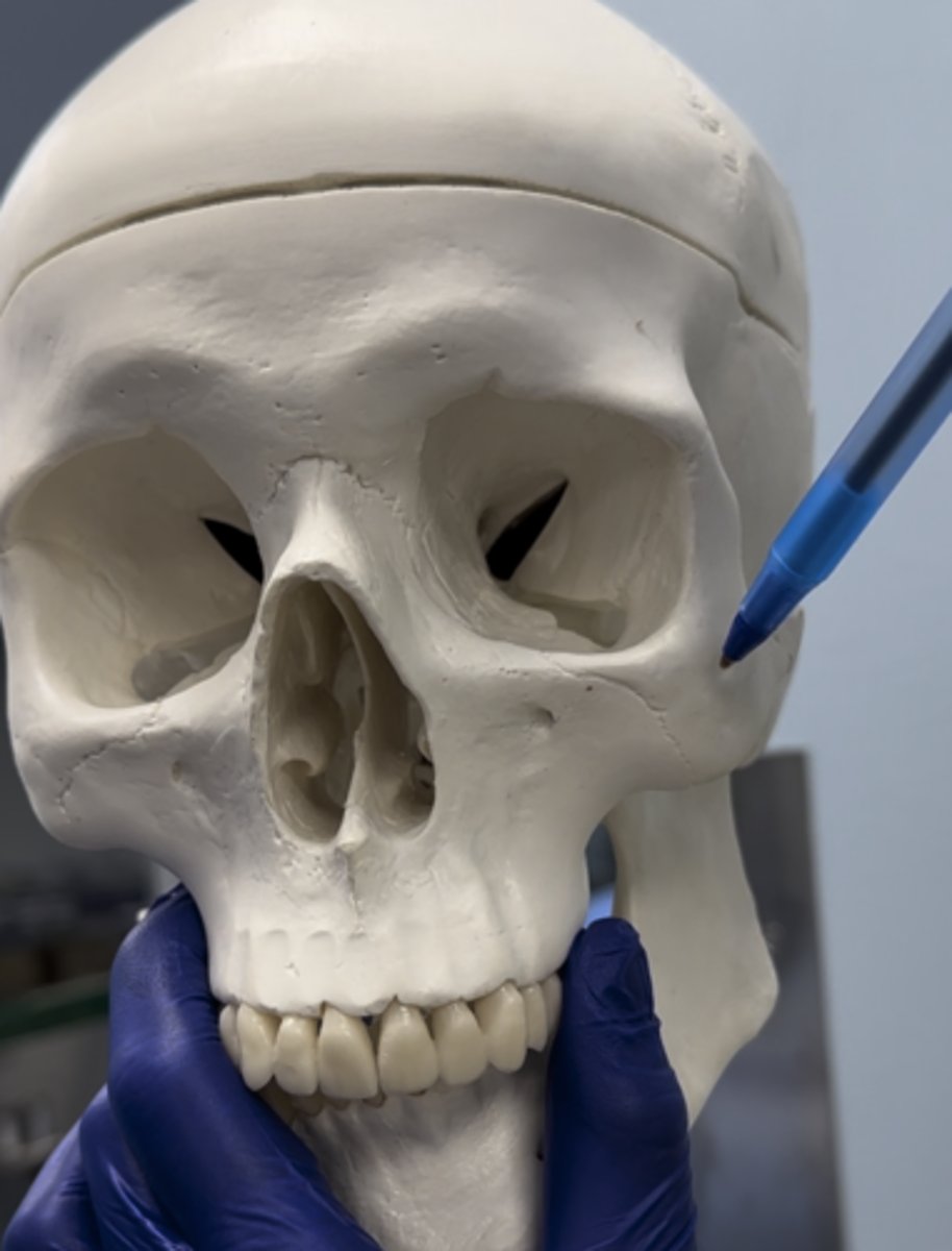 <p>Bone pointed at</p>