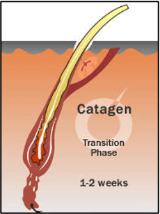 <p>transition stage between anagen and telogen</p><p>lasts only 2-3 weeks</p><p>hair continues to grow at decreasing rate</p>