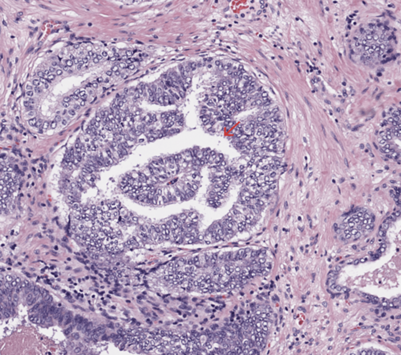 <p>Prostate</p>