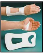 <ul><li><p><span>Stronger mechanical support of the wrist and frees up some of the palmar surface for sensory input</span></p></li><li><p><span>Distributes pressure over the larger dorsal wrist surface area</span></p></li><li><p><span>Better tolerated by edematous hand</span></p></li></ul><p></p>