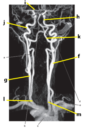 <p>What is letter k ?</p>