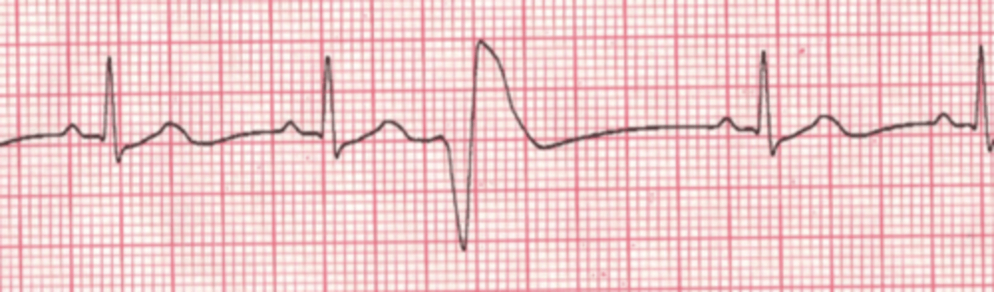 <p>Name the rhythm</p>