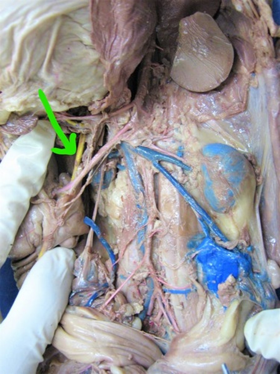 <p>identify this vein</p>
